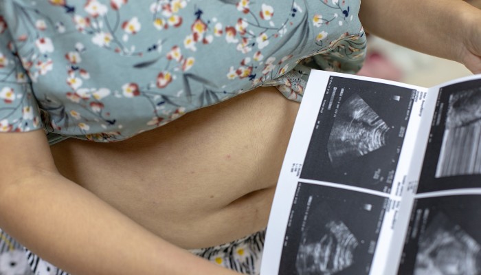 Woman Looking at Her Sonogram Images